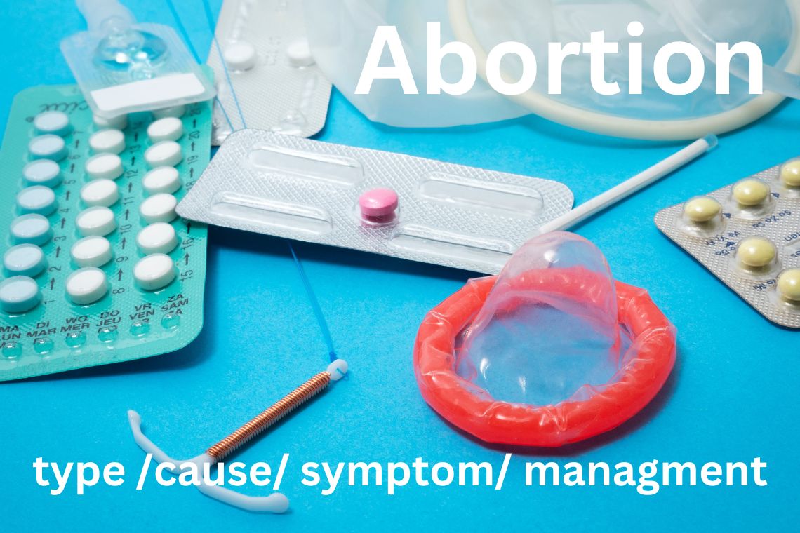 comprehensive guide to abortion