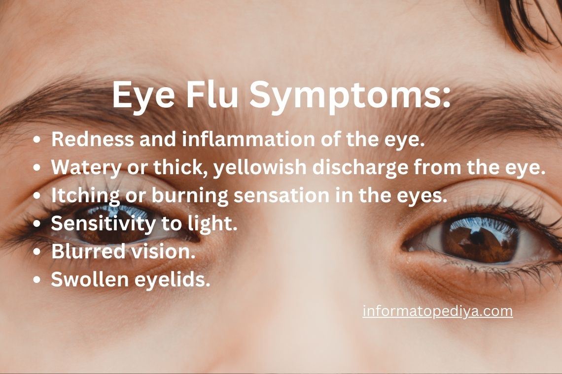 eye flu