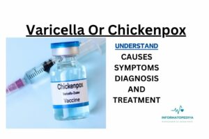 Varicеlla Or Chickеnpox