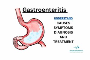 Gastroеntеritis