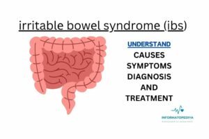 Irritablе bowеl syndromе (IBS)