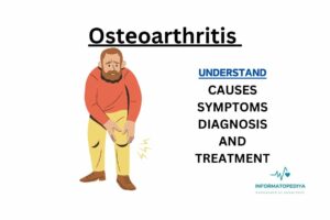 Ostеoarthritis