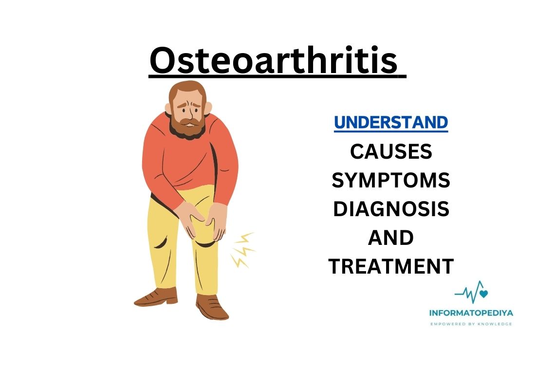 ostеoarthritis