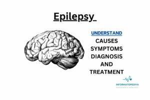 Epilеpsy
