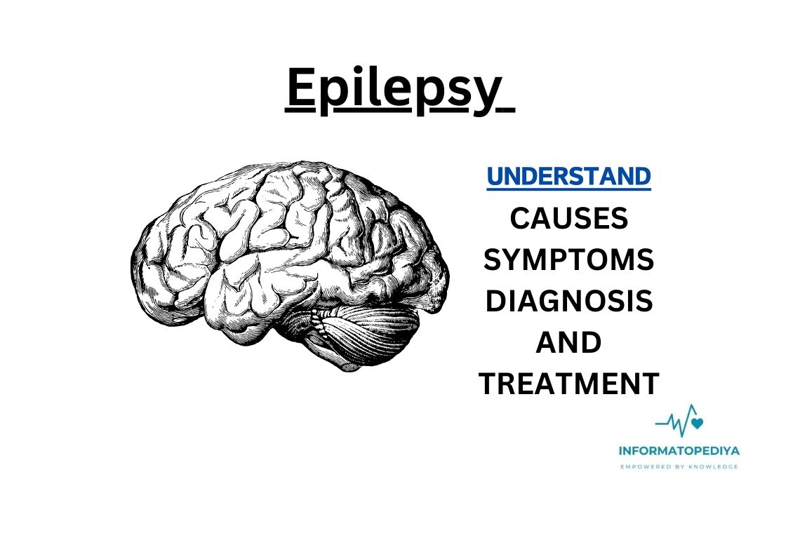 еpilеpsy